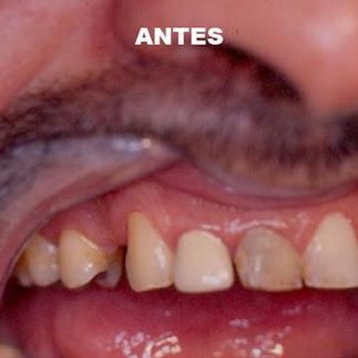 Clínica Dental José J. Pinilla Melguizo Tratamiento 1-1