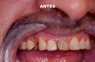 Clínica Dental José J. Pinilla Melguizo Tratamiento 1-1