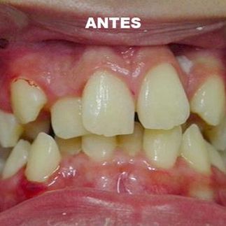 Clínica Dental José J. Pinilla Melguizo Tratamiento 5-1