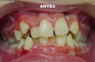 Clínica Dental José J. Pinilla Melguizo Tratamiento 5-1