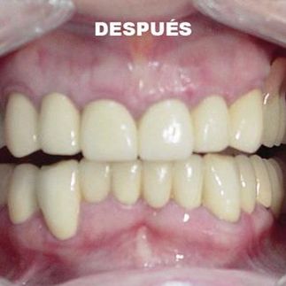 Clínica Dental José J. Pinilla Melguizo Tratamiento 4- 2