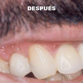 Clínica Dental José J. Pinilla Melguizo Tratamiento 1-2