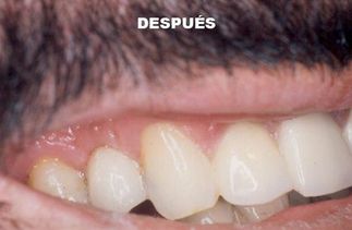 Clínica Dental José J. Pinilla Melguizo Tratamiento 1-2