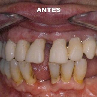 Clínica Dental José J. Pinilla Melguizo Tratamiento 2-1