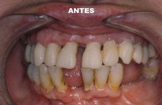 Clínica Dental José J. Pinilla Melguizo Tratamiento 2-1