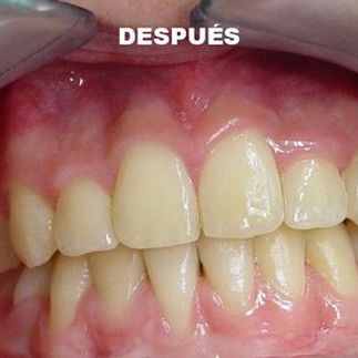 Clínica Dental José J. Pinilla Melguizo Tratamiento 5-2