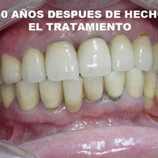 Clínica Dental José J. Pinilla Melguizo Tratamiento 2-2